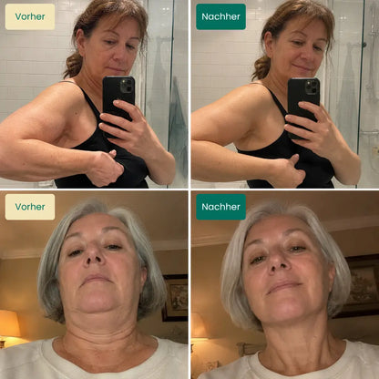 Lyvea® Lymphdrainage-Tropfen